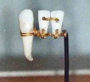 Ancient Egypt Dentist