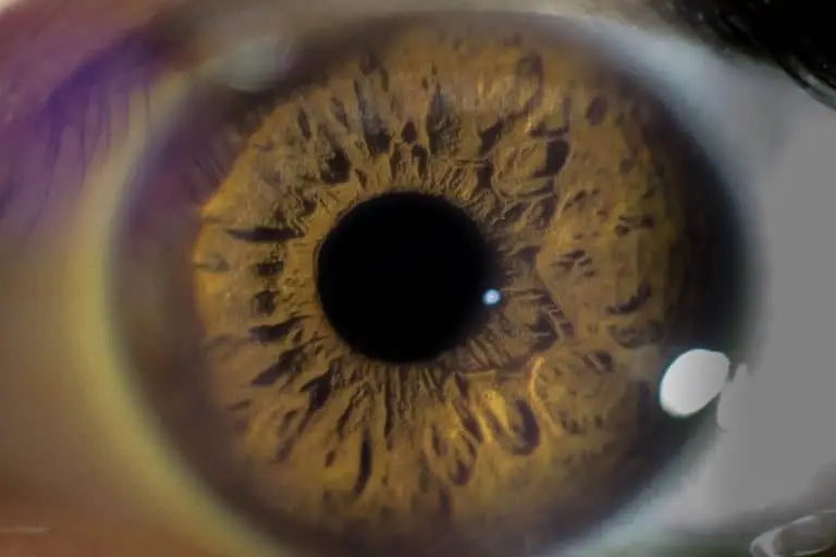 aging vision problems