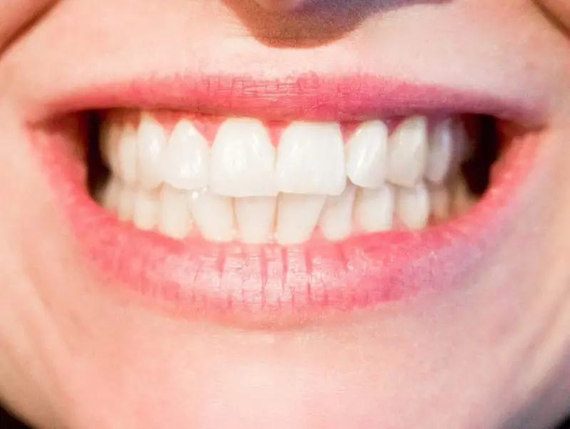Interpreting dental codes