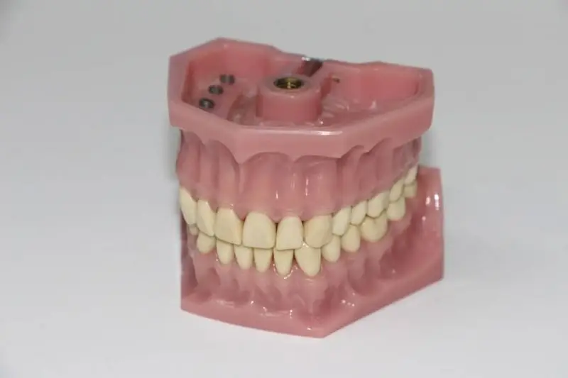 history of dentures