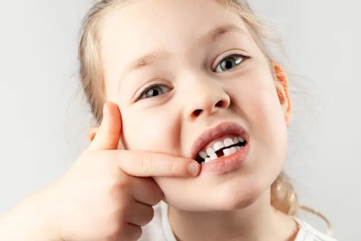 Missing Teeth
